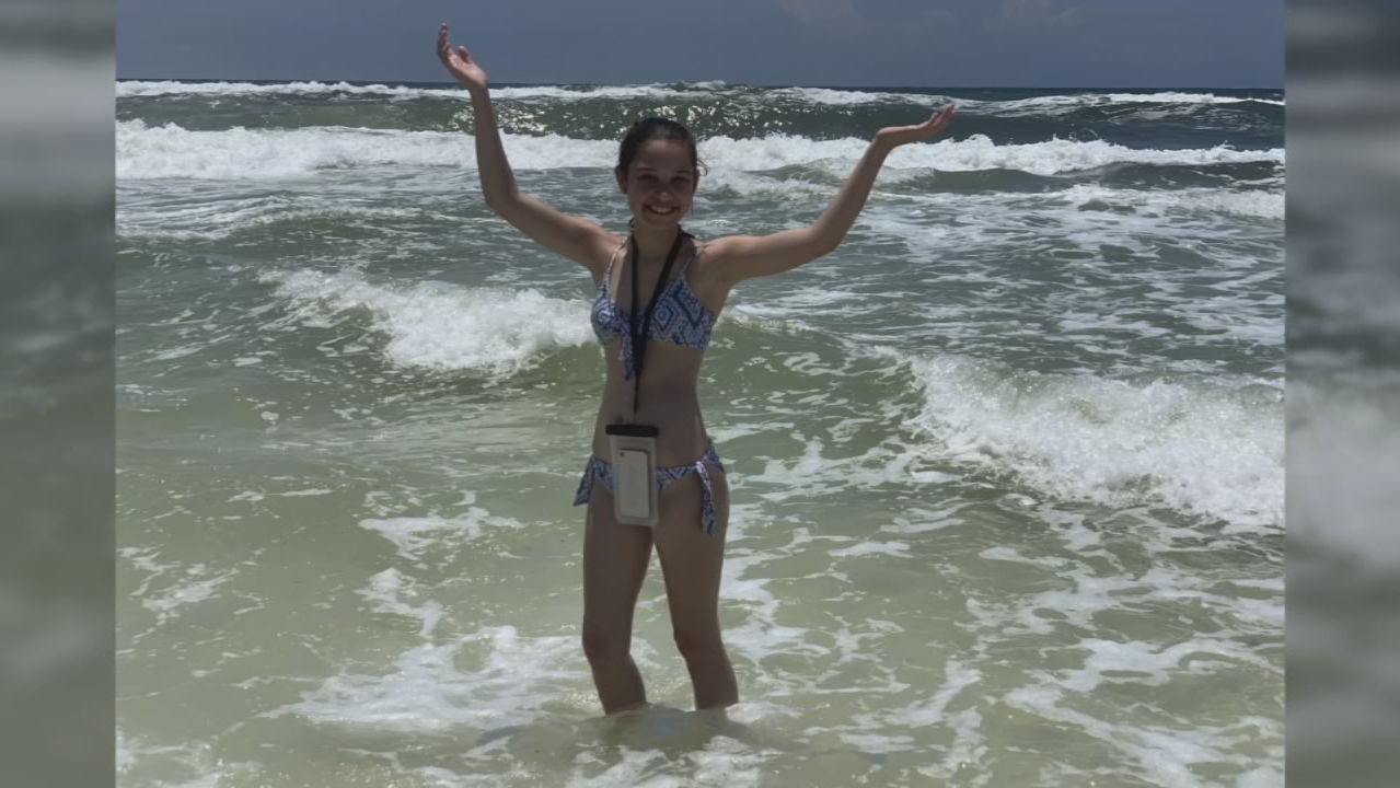 INDIANA GIRL - FLESH EATING BACTERIAL IN FLORIDA - WXIN - 6-26-19 (1).jpg